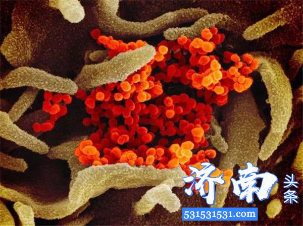 新冠病毒在电子显微镜长什么样?来看看这组图像