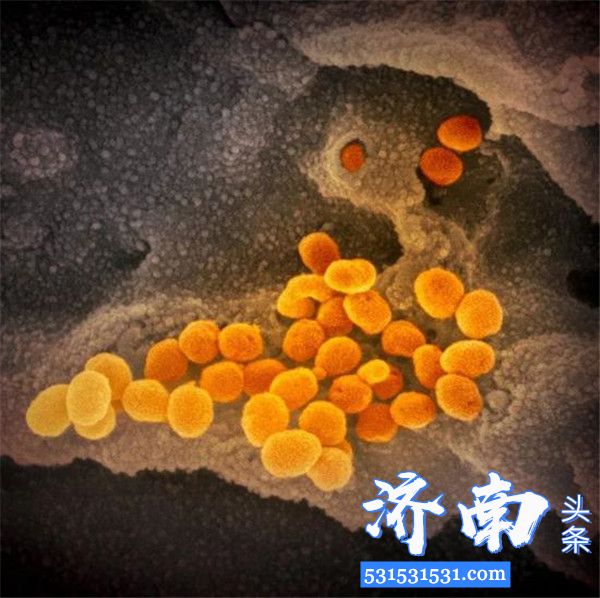 新冠病毒在电子显微镜长什么样?来看看这组图像
