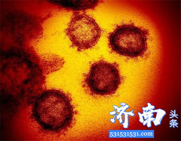 新冠病毒在电子显微镜长什么样?来看看这组图像