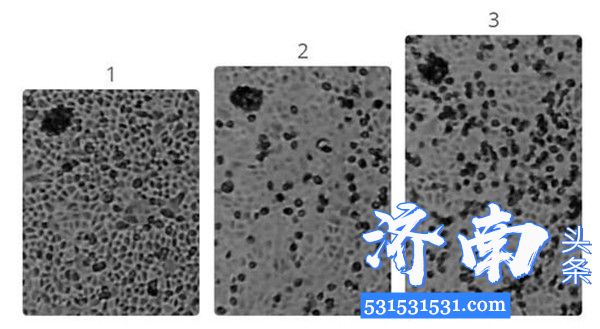 新冠病毒在电子显微镜长什么样?来看看这组图像