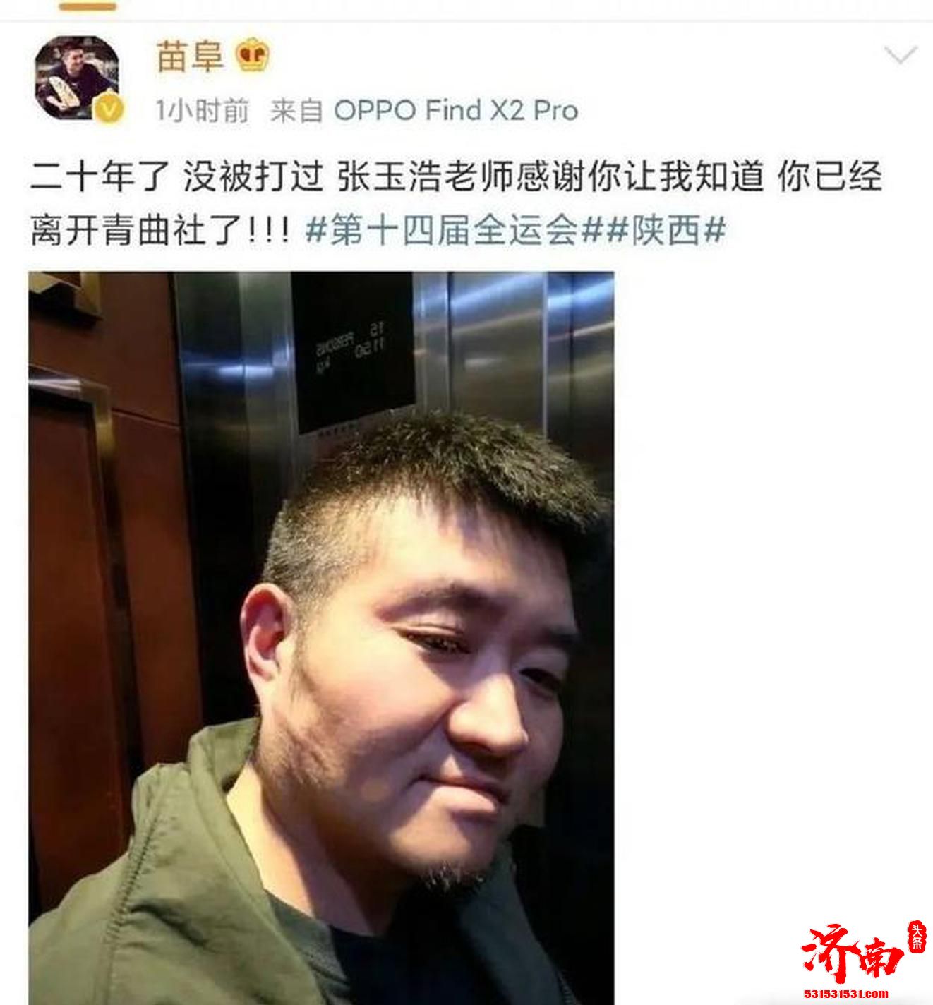 苗阜晒脸部抓伤照自曝被张玉浩打 后又删除微博 苗阜晒脸部抓伤照自曝被张玉浩打 后又删除微博