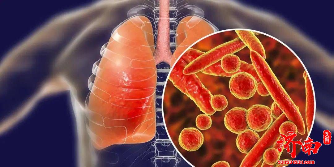 河北省新增82例本地确诊病例和49例本地无症状感染者,均为石家庄市报告 河北省新增82例本地确诊病例和49例本地无症状感染者,均为石家庄市报告