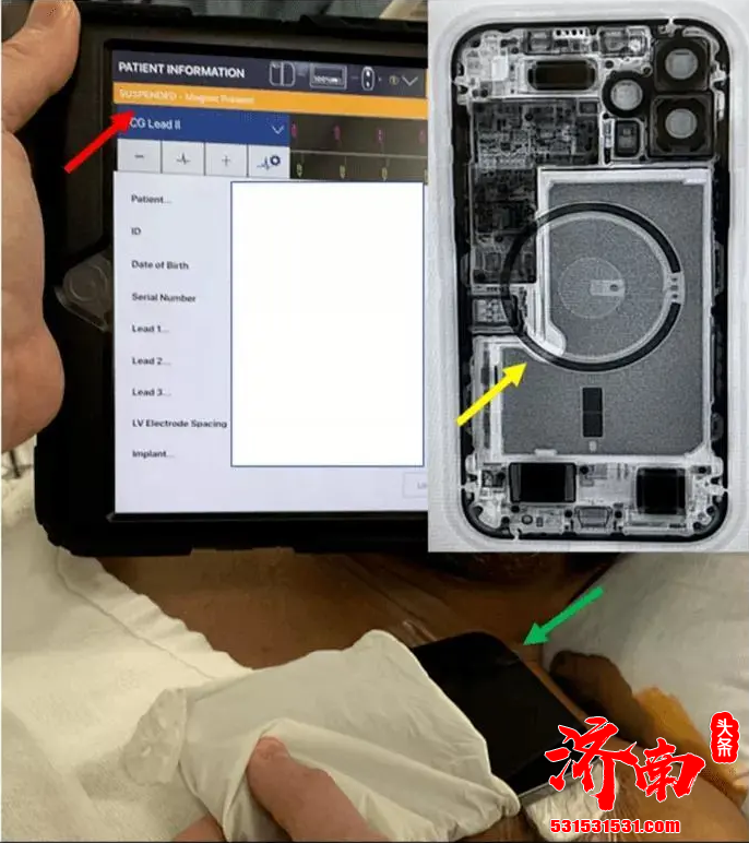 苹果官网发布警告 不要将iPhone12和MagSafe配件太靠近ICD等医疗设备 苹果官网发布警告 不要将iPhone12和MagSafe配件太靠近ICD等医疗设备