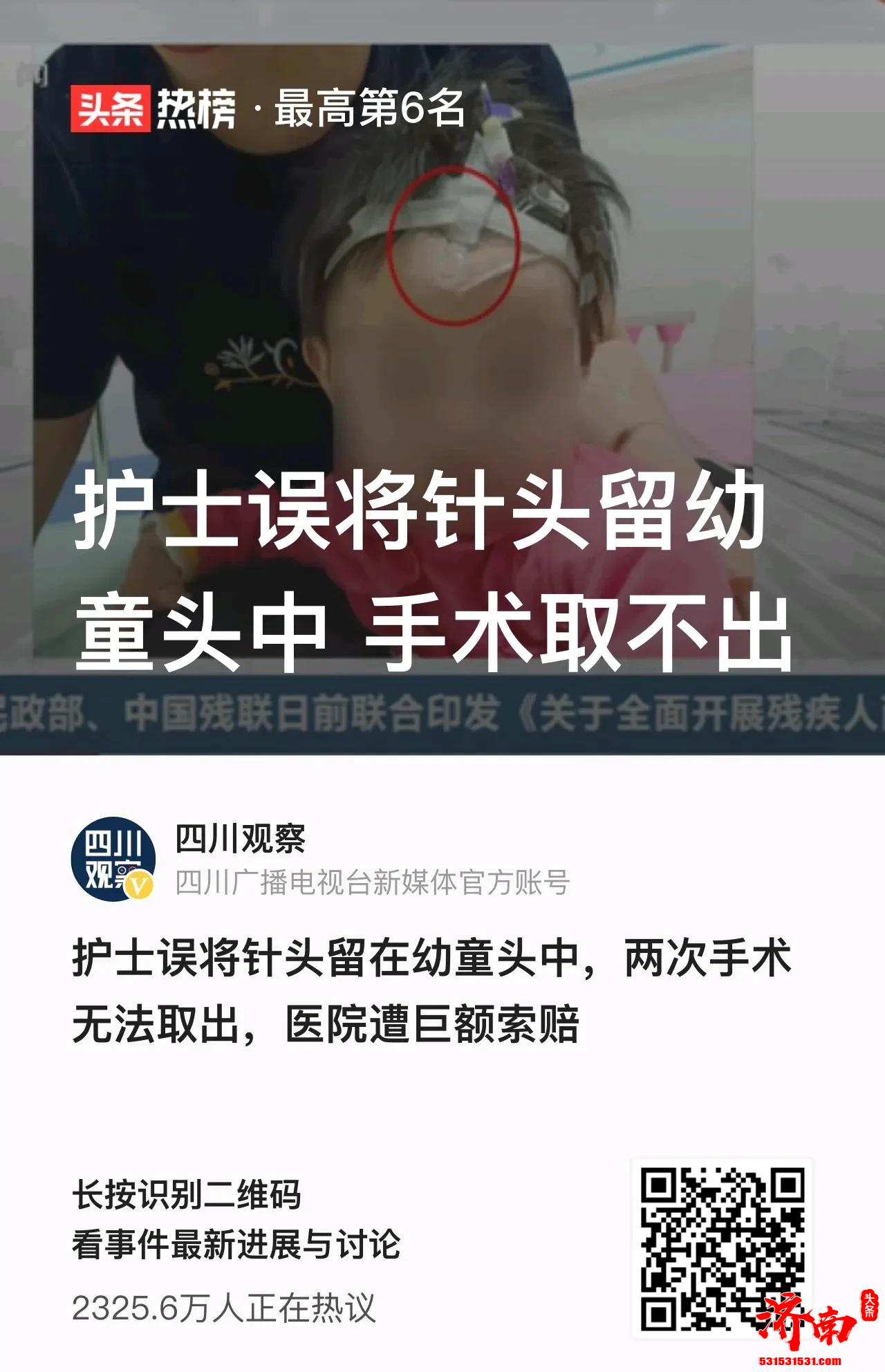 小宝宝输液留置针软管误留在头里 两次手术取不出来 头部大疤痕已构成十级伤残